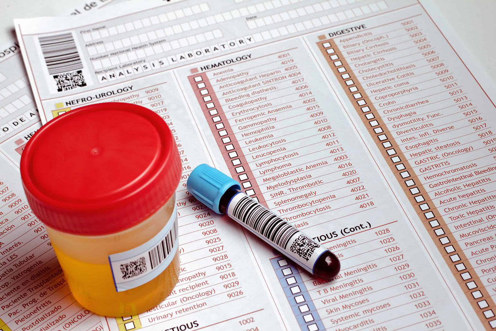 Green Lotus Drug Screen Blood Work